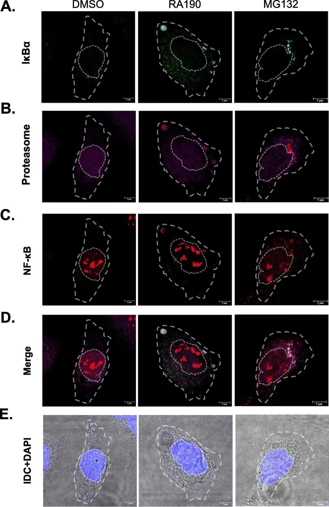 Immunocytochemistry/ Immunofluorescence: Proteasome 19S 10B Antibody [NB100-1483] - RA190 causes accumulation of I kappa B alpha  & NF-kappa B in the cytoplasm, co-localized with proteasomes. HepG2 cells were treated with DMSO, 2 μM RA190 for or 25 μM MG132 for 30 min. The cells were fixed, permeabilized & stained for I kappa B alpha  a, proteasome b, NF-kappa B c & viewed by confocal fluorescence microscopy individually, or d merged, or e under phase contrast. a, b, c I kappa B alpha  & NF-kappa B in RA190 & MG132-treated cells is significantly accumulated in cytoplasm, & apparently co-localized with the proteasome. The proportion of fluorescence in the cytoplasm versus the nucleus was quantified for f I kappa B alpha , or g NF-kappa B Image collected & cropped by CiteAb from the following publication (//pubmed.ncbi.nlm.nih.gov/32375699), licensed under a CC-BY license. Not internally tested by Novus Biologicals.