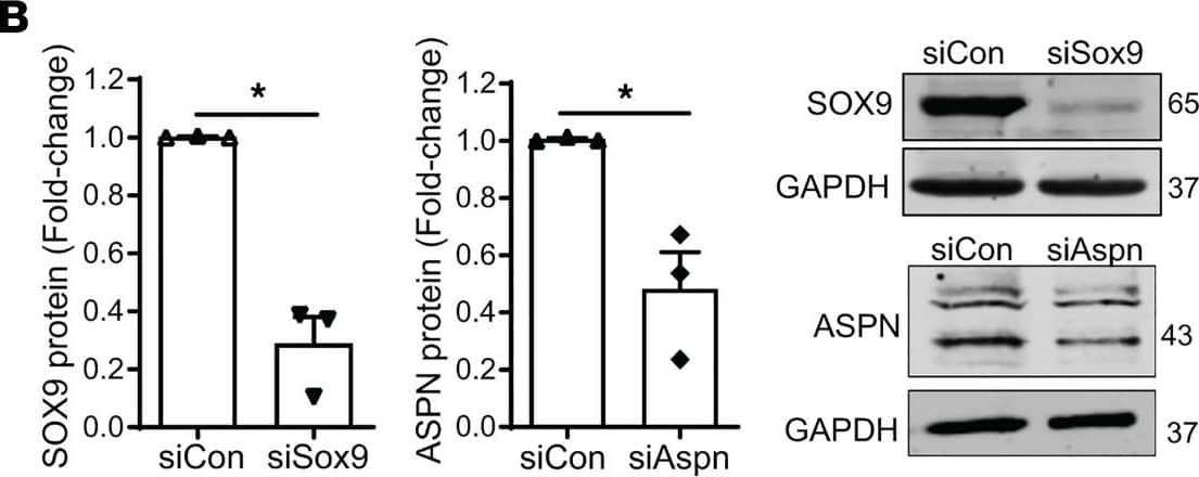Western Blot Asporin Antibody