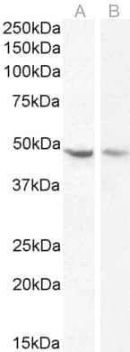 Western Blot Serpin I1/Neuroserpin Antibody