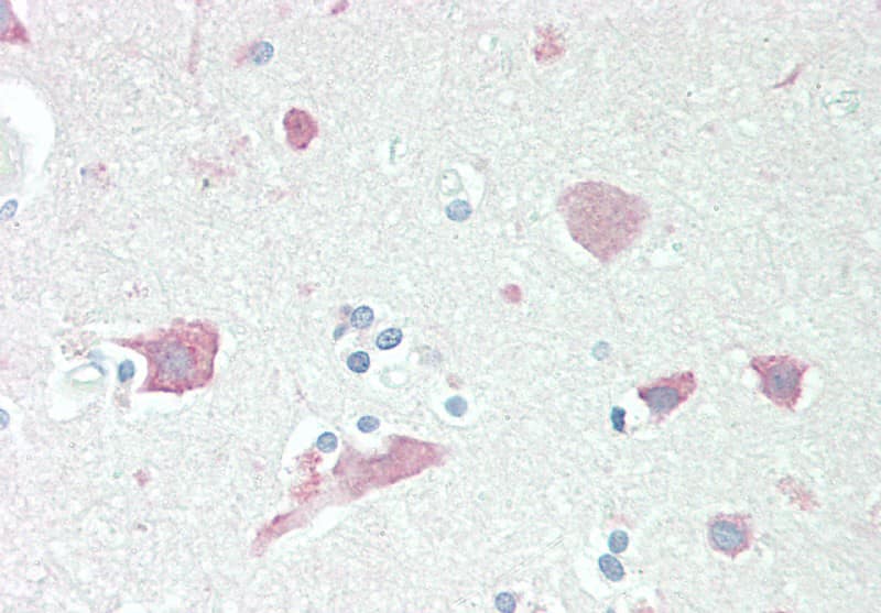 Immunohistochemistry-Paraffin: Serpin I1/Neuroserpin Antibody [NB100-1529] - (5ug/ml) staining of paraffin embedded Human Cortex. Steamed antigen retrieval with citrate buffer pH 6, AP-staining.