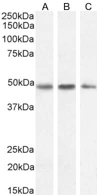 Western Blot Serpin I1/Neuroserpin Antibody