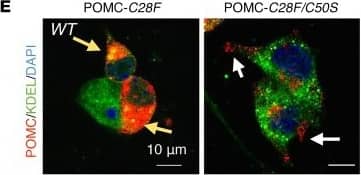 Immunocytochemistry/ Immunofluorescence: POMC Antibody [NB100-1533] - Pathogenic POMC-C28F mutation is completely rescued by an intragenic suppressor mutation C50S.(A) Schematic diagram showing the sequence & positions of Cys residues in POMC-WT, C28F, & C28F/C50S. (B) Western blot analyses of POMC-Flag immunoprecipitates in HEK293T cells transfected with a combination of Myc- or Flag-tagged POMC under nonreducing (– beta -ME) & reducing (+ beta -ME) SDS-PAGE. Two panels were from the same experiment at the same exposure time, with the irrelevant lanes in the middle cut off. (C) Sucrose gradient fractionation & Western blot analysis of HEK293T cells expressing POMC-C28F or -C28F/C50S under nonreducing (– beta -ME) & reducing (+  beta -ME) SDS-PAGE. (D) Metabolic labeling experiments to visualize the maturation of nascent POMC in HEK293T cells transfected with POMC-Myc. Cells were pulsed for 30 minutes & chased for the indicated times, followed by immunoprecipitation with anti-Myc agarose beads & separation on SDS-PAGE gels under nonreducing or reducing conditions & autoradiography. (E) Representative confocal images of POMC in POMC-transfected WT N2a cells. White arrows point to secreted POMC in granules, while yellow arrows point to perinuclear POMC, possibly in the form of aggregates. KDEL marks the ER. Representative data from at least 2 independent experiments shown. Image collected & cropped by CiteAb from the following publication (//www.jci.org/articles/view/96420), licensed under a CC-BY license. Not internally tested by Novus Biologicals.