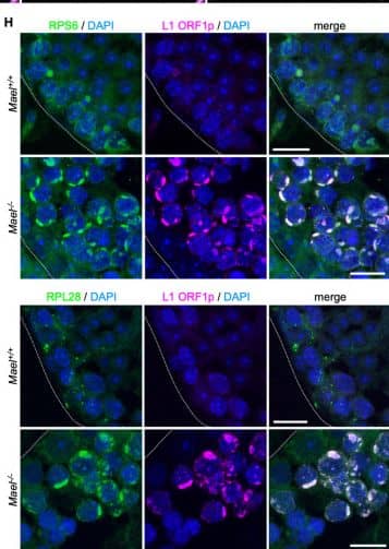 L1 bodies (LBs) are large cytoplasmic compartments enriched in ORF1p, L1 mRNA, and ribosomes.(A–E) Electron micrographs exemplifying the formation of LBs in Mael-/- spermatocytes. Boxed areas in A and B identify small cytoplasmic aggregates magnified in A’ and B’, respectively. Boxed area in C identifies an intermediate size LB magnified in C’. D and E show more prominent LBs, partially surrounded by a bilayer membrane (red arrows). Nuc: nucleus. Cyto: cytoplasm. NE: nuclear envelope. (F) Immunofluorescence staining of L1 ORF1p on Mael-/- spermatocytes shows ORF1p accumulation in LBs (left panel, magenta). 3D reconstruction of LBs (magenta) and nuclei (blue) (middle and right panels); numbers [1–5] are used to label corresponding cells. Scale bars: 5 μm. (G) HCR RNA-FISH of L1 RNA (green) and immunofluorescence staining of L1 ORF1p (magenta) on Mael+/- and Mael-/- testis sections. Scale bars: 5 μm. (H) Double immunofluorescence staining of ribosomal protein S6 (RPS6, top two rows, green) or L28 (RPL28, bottom two rows, green) and L1 ORF1p (magenta) showing their colocalization in LBs. Dotted white lines mark seminiferous tubule boundaries. Scale bars: 15 μm. See also S1 Fig. Image collected and cropped by CiteAb from the following open publication (//pubmed.ncbi.nlm.nih.gov/37307272), licensed under a CC-BY license. Not internally tested by Novus Biologicals.