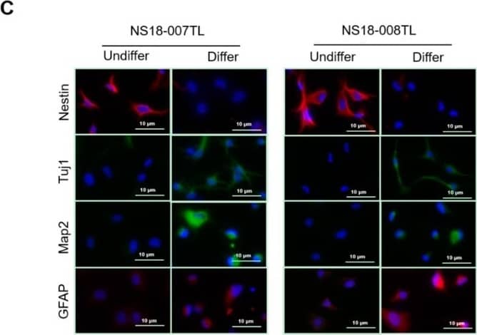 Immunocytochemistry/ Immunofluorescence: Nestin Antibody [NB100-1604] - In vitro proliferation & differentiation of ahMNCs-Clump II. (A) ahMNCs-Clump II were propagated in the culture condition for ahMNCs. The accumulated number of cells of ahMNCs-Clump II (NS18-007TL & 008TL) in comparison with ahMNCs established using previous culture methods (NS14-010TL, NS14-011TL, & NS15-001TL). Days to 1 × 109 cells are indicated. (B) Morphologies of ahMNCs-Clump II under expansion processes are illustrated until third in vitro passage (P3). Scale bar = 50 μm. (C) After in vitro differentiation, immunofluorescence was applied to ahMNCs-Clump II. Nestin for NSCs, MAP2 & Tuj1 for neurons, & GFAP for astrocytes. Undiffer = before in vitro differentiation; Differ = after in vitro differentiation. Scale bar = 10 μm. Image collected & cropped by CiteAb from the following publication (//pubmed.ncbi.nlm.nih.gov/30380605), licensed under a CC-BY license. Not internally tested by Novus Biologicals.