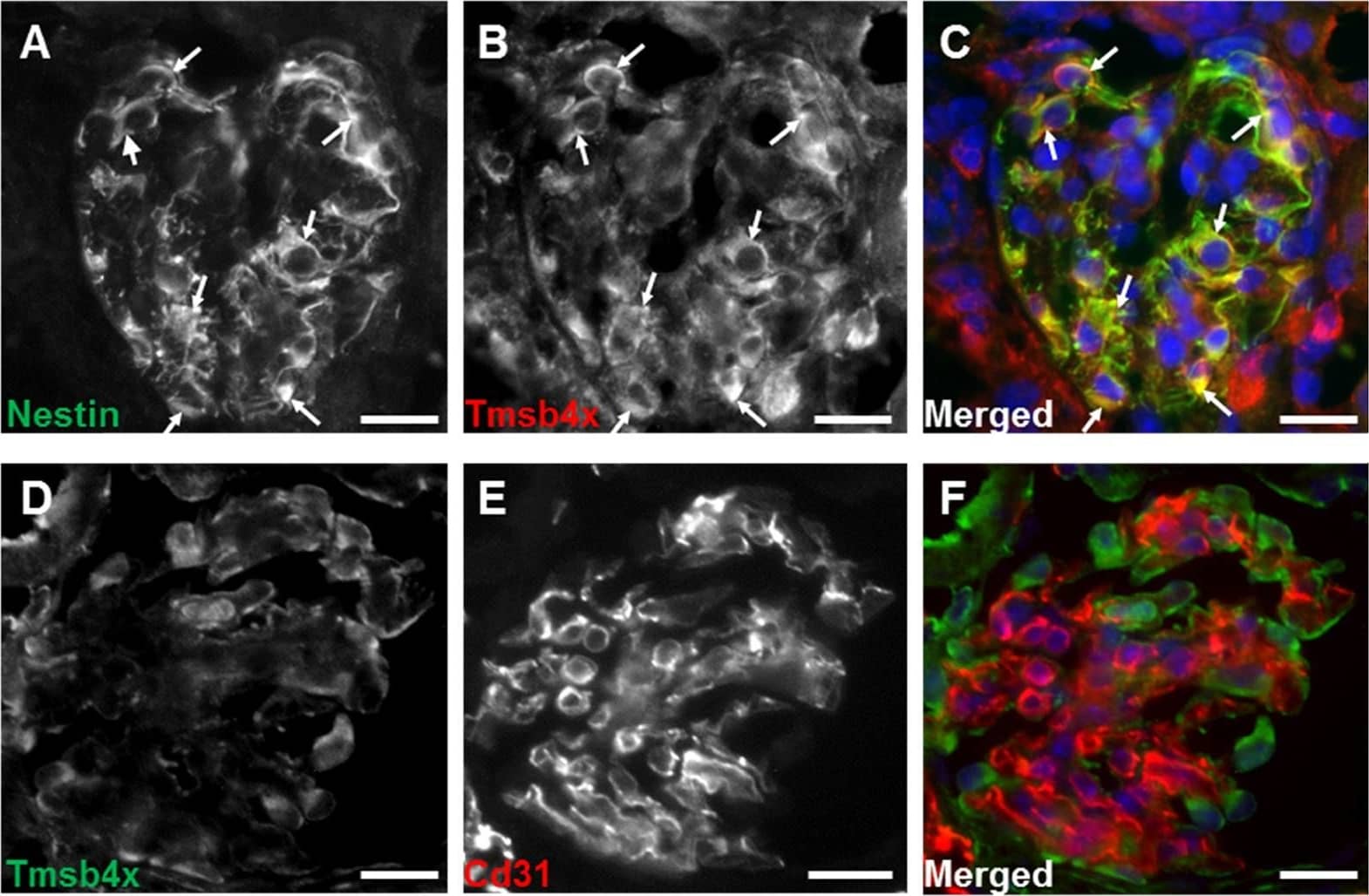 Immunocytochemistry/ Immunofluorescence: Nestin Antibody [NB100-1604] - Representative images of nestin (A) & Tmsb4x (B) staining in the mouse adult wild-type glomerulus visualized by fluorescent microscopy. (C) Merged images showing Tmsb4x (red) & nestin (green) staining; areas of colocalization are indicated by arrows. Representative images of Tmsb4x (D) & Cd31 (E) staining in the mouse adult wild-type glomerulus visualized by fluorescent microscopy. (F) Merged images showing Tmsb4x (green) & Cd31 (red) staining. Bar = 20 μm. Image collected & cropped by CiteAb from the following publication (//pubmed.ncbi.nlm.nih.gov/27575556), licensed under a CC-BY license. Not internally tested by Novus Biologicals.