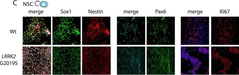 Immunocytochemistry/ Immunofluorescence: Nestin Antibody [NB100-1604] - Neural Stem Cell derivation from WT & LRRK2 G2019S hiPSCs.Haematoxylin & eosin coloration of teratoma-encapsulated tumors generated by flank injection of WT & G2019S hiPSCs cells in Nod/Scid mice. Representative images of the different germ layers: ectoderm (immature squamous epithelium, neural rosettes), mesoderm (primitive cartilage, muscles, fat) & endoderm (primitive gut like epithelium) (A). Scheme showing the different steps of the DA neuron derivation protocol (B). Immunolabelings of cultured WT & LRRK2 G2019S hIPSCs for different NSCs markers after NSCs induction protocol: Sox1, Nestin, Pax6 & Ki67 (C). Analysis of gene expression levels by qRT-PCR for WT & LRRK2 G2019S cultures at the end of the NSCs induction protocol (D). Image collected & cropped by CiteAb from the following publication (//www.nature.com/articles/srep33377), licensed under a CC-BY license. Not internally tested by Novus Biologicals.