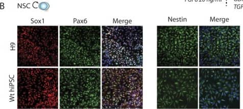 Immunocytochemistry/ Immunofluorescence: Nestin Antibody [NB100-1604] - Dopaminergic neuron derivation from H9 stem cells & hIPSCs.Scheme showing the different steps of the DA neuron derivation protocol (A). Immunolabelings of cultured H9 (top panels) & WT hiPSCs (bottom panels) for different NSCs markers, Sox1, Pax6 & Nestin (B). Immunolabeling of cultured H9 (top panels) & WT hiPSCs (bottom panels) after 3 days of DA progenitor induction for progenitor markers Lmx1A & FoxA2 (C) & after 7 days of induction for immature neurons  beta III-Tubulin+ & remaining progenitors Sox1+ (D). Immunolabelings of cultured H9 (top panels) & WT hiPSCs (bottom panels) after 21 days of induction for the neuronal marqueur MAP2 & DA neurons Tyrosine Hydroxylase (TH) (E). Analysis of gene expression levels by qRT-PCR for cultured H9 (top panels) & WT hiPSCs at different time points (NSC, 14 days & 21 days) of the culture (FB = fetal brain) (F,G). Image collected & cropped by CiteAb from the following publication (//www.nature.com/articles/srep33377), licensed under a CC-BY license. Not internally tested by Novus Biologicals.