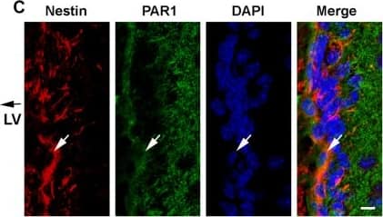 Immunocytochemistry/ Immunofluorescence: Nestin Antibody [NB100-1604] - PAR1 is expressed by neural stem cells in the sub-ventricular zone (SVZ) of the adult mouse brain. Photomicrographs show immunofluorescence double-labeling for PAR1 with Sox2-positive (A), or PAR1 with Nestin-positive (C) multipotent neural stem cells (NSCs) within the lateral wall of the lateral ventricle (LV). RNAscope was used to identify cells expressing both PAR1 & Sox2 (B), or Nestin (D) RNA in NSCs of the adult SVZ. Arrow indicates an example of a double-labeled cell in each case, with arrowhead indicating a singly labeled cell (Scale bar = 10 μm). Boxed area in B & D is also shown at higher magnification to visualize double-labeled cells. (E) Histogram shows expression of PAR1 RNA was high in NSCs grown as neurospheres (NS), or when plated on poly-L-lysine coated coverslips as monolayers in stem cell media containing EGF & bFGF. PAR1 RNA expression by NSC monolayers decreased by 87% when EGF & bFGF were removed from the media for 7 DIV promoting stem cell differentiation. (F) Withdrawal of EGF & bFGF to induce NSC monolayer differentiation resulted in a parallel decrease in Nestin RNA expression. (**P < 0.01, ***P < 0.001 Students t-test). Image collected & cropped by CiteAb from the following publication (//pubmed.ncbi.nlm.nih.gov/29921916), licensed under a CC-BY license. Not internally tested by Novus Biologicals.