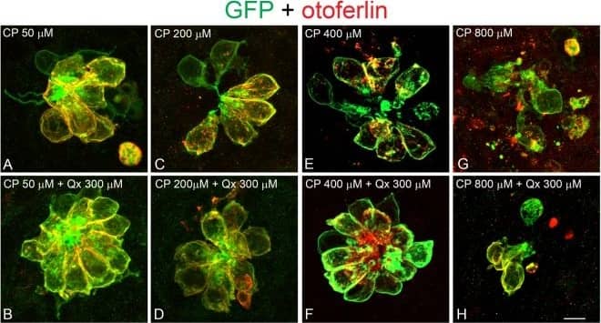 Immunocytochemistry/ Immunofluorescence: GFP Antibody [NB100-1614] - Dose protection curve against CP. 5dpf Tg(brn3c:GFP) larvae were incubated with 50 µM to 800 µM of CP (A,C,E,G) for 6 hours or pre-treated with 300 µM of Qx for 2 hours & then co-treated with Qx & CP (50µM-800µM) for 6 hours (B,D,F,H). Animals were fixed & immunostained for GFP (green) & otoferlin (red). Control animals were exposed to vehicle alone (DMSO). (I) Quantification of the number of hair cells per neuromast after the different treatments represented as mean +/− SEM. One-way ANOVA, Dunnett post test. ***p < 0.001. Black asterisks compared versus DMSO-treated animals. Red asterisks compared versus the corresponding CP concentration. (J) Scores for neuromast morphology (see Materials & Methods). Scale bar: 6 μm. Data were taken from at least 20 animals & 3 experiments runs. Image collected & cropped by CiteAb from the following publication (//pubmed.ncbi.nlm.nih.gov/30310154), licensed under a CC-BY license. Not internally tested by Novus Biologicals.