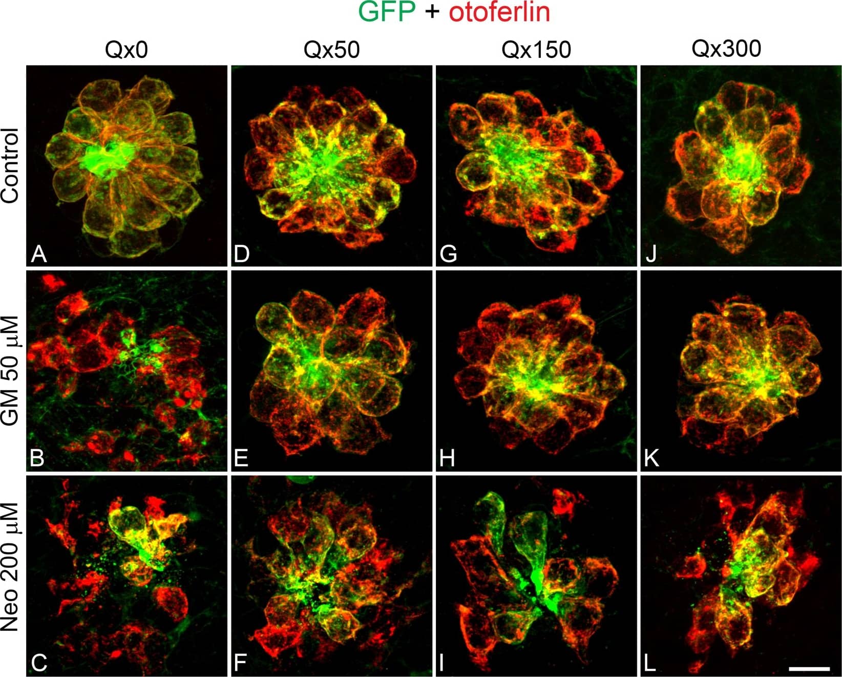 Immunocytochemistry/ Immunofluorescence: GFP Antibody [NB100-1614] - Dose protection curve against aminoglycosides. 5dpf larvae were incubated with vehicle (E3, A) or with 50 μM (D–F), 150 μM (G–I) or 300 μM (J–L) of Qx for a total of 8 hours. Gentamicin (GM, 50 μM, B,E,H,K) or neomycin (Neo, 200 µM,C,F,I,L) were added during the last 60 min or 30 min of incubation, respectively. Animals were fixed & stained for otoferlin (red) & GFP (green). (M) Quantification of the number of hair cells per neuromast after the different treatments represented as mean +/− SEM. Note that since no significant differences were found in the number of hair cells per neuromast when animals were incubated with the different Qx concentrations (0–300 µM, A,D,G,J), the control value represents the average of all these treatments. One-way ANOVA, Dunnett post test. *p < 0.05, **p < 0.01, ***p < 0.001. Black asterisks compared versus control. Red asterisks compared versus the corresponding aminoglycoside-only treatment. (N) Scores for neuromast morphology (see Materials & Methods). Scale bar: 7 μm. Data were taken from at least 20 animals & 3 experiments runs. Image collected & cropped by CiteAb from the following publication (//pubmed.ncbi.nlm.nih.gov/30310154), licensed under a CC-BY license. Not internally tested by Novus Biologicals.