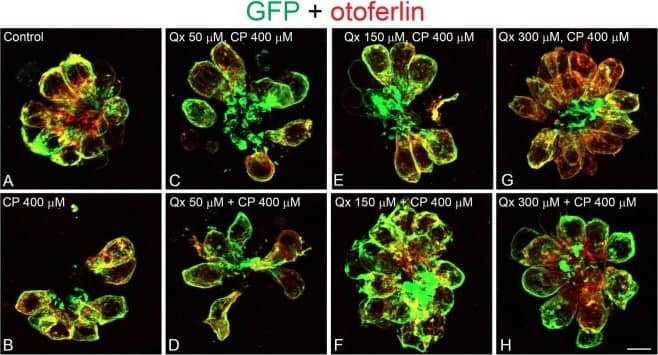 Immunocytochemistry/ Immunofluorescence: GFP Antibody [NB100-1614] - Qx protects against cisplatin ototoxicity. 5dpf Tg(brn3c:GFP) larvae were incubated with vehicle alone (DMSO, A), 400 μM of cisplatin (CP, B), pre-treated with Qx for 2 hours & then incubated with CP for 6 hours (Qx, CP, C,E,G) or pre-treated with Qx for 2 hours & then co-treated with Qx & CP for 6 more hours (Qx + CP, D,F,H). Animals were fixed & immunostained for GFP (green) & otoferlin (red). (I) Quantification of the number of hair cells per neuromast after the different treatments represented as mean +/− SEM. One-way ANOVA, Dunnett post test. *p < 0.05, ***p < 0.001. Black asterisks compared versus control. Red asterisks compared versus CP 400 µM. (J) Scores for neuromast morphology (see Materials & Methods). Scale bar: 6 μm. Data were taken from at least 20 animals & 3 experiments runs. Image collected & cropped by CiteAb from the following publication (//pubmed.ncbi.nlm.nih.gov/30310154), licensed under a CC-BY license. Not internally tested by Novus Biologicals.