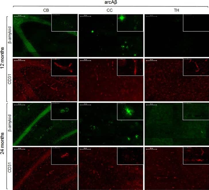 Immunohistochemistry for vessel staining (CD31) and  beta -amyloid comparing 13- and 24-month old arcA beta  mice. Overviews (scale bars = 200 μm) of the corpus callosum (CC), thalamus (TH), and cerebellum (CB). Insets show the regions with higher magnification (scale bar = 50 μm). Image collected and cropped by CiteAb from the following open publication (//pubmed.ncbi.nlm.nih.gov/26834622), licensed under a CC-BY license. Not internally tested by Novus Biologicals.