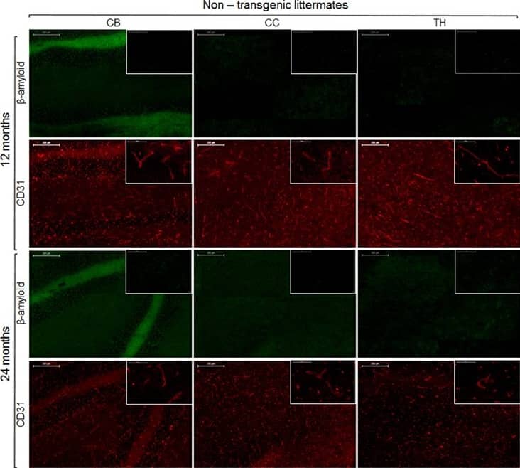 Immunohistochemistry for vessel staining (CD31) and  beta -amyloid comparing 13- and 24-month old non-transgenic littermates. Overviews (scale bars = 200 μm) of the corpus callosum (CC), thalamus (TH), and cerebellum (CB). Insets show the regions with higher magnification (scale bar = 50 μm). Image collected and cropped by CiteAb from the following open publication (//pubmed.ncbi.nlm.nih.gov/26834622), licensed under a CC-BY license. Not internally tested by Novus Biologicals.
