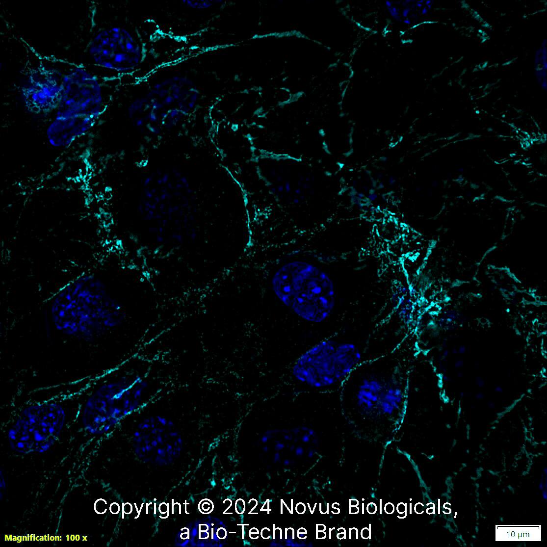 CD31/PECAM-1 (MEC 7.46) was detected in immersion fixed MS1 mouse pancreas/Islet of Langerhans endothelial cell line using Rat anti-CD31/PECAM-1 (MEC 7.46) Protein-G purified Monoclonal Antibody conjugated to Alexa Fluor® 647 (Catalog # NB100-1642AF647) (light blue) at 2 µg/mL overnight at 4C. Cells were counterstained with DAPI (blue). Cells were imaged using a 100X objective and digitally deconvolved.    