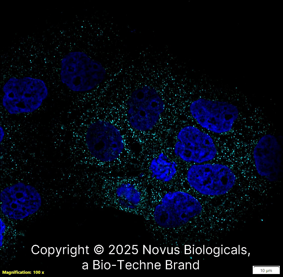 Desmoglein-3 Antibody (5G11) was detected in immersion fixed A431 human skin carcinoma cell line using Mouse anti-Desmoglein-3 Antibody (5G11) Protein G Purified Monoclonal Antibody conjugated to Alexa Fluor® 488 (Catalog # NB100-1643AF647) (light blue) at 10 µg/mL overnight at 4C. Cells were counterstained with DAPI (blue). Cells were imaged using a 100X objective and digitally deconvolved.