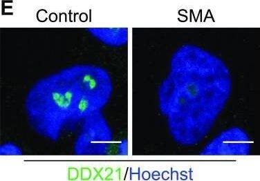 Survival motor neuron (SMN)–deficient motor neurons exhibit reduced DDX21 levels in a cell autonomous manner.(A) p75 enriched motor neurons derived from SMN delta 7 and wild type E13 embryos were labelled with DDX21 antibody, at DIV7. Scale bars represent 5 μm. (B, C, D) Nuclear, (C) nucleoplasmic and (D) foci fluorescence intensity of DDX21 staining normalised to control. Bar graphs of mean +/- s.d. *P < 0.05; paired two-tailed t test (P = 0.0417). (E) iPSC-derived motor neurons isolated from healthy individuals (csi4i and miff) and spinal muscular atrophy (SMA) type I patients (SMA86 and SMA32) were labelled with DDX21 antibody. Scale bars represent 5 μm. (F) Nuclear fluorescence intensity of DDX21 staining normalised to the average of control samples. (G) Nuclear fluorescence intensity where control samples (csi4i and miff) and SMA samples (SMA68 and SMA32) have been pulled together. (H) Nucleoplasmic fluorescence intensity of DDX21 staining normalised to the average of control samples. (I) Nucleoplasmic fluorescence intensity where control samples (csi4i and miff) and SMA samples (SMA68 and SMA32) have been pulled together. (J) Foci fluorescence intensity of DDX21 staining normalised to the average of control samples. (K) Foci fluorescence intensity where control samples (csi4i, miff) and SMA samples (SMA68, SMA32) have been pulled together. Bar graphs of mean +/- s.d. *P < 0.05; paired two-tailed t test (P = 0.0344). Image collected and cropped by CiteAb from the following open publication (//pubmed.ncbi.nlm.nih.gov/35440492), licensed under a CC-BY license. Not internally tested by Novus Biologicals.