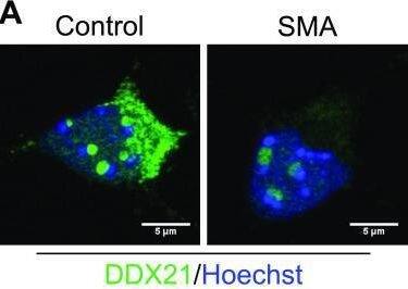 Survival motor neuron (SMN)–deficient motor neurons exhibit reduced DDX21 levels in a cell autonomous manner.(A) p75 enriched motor neurons derived from SMN delta 7 and wild type E13 embryos were labelled with DDX21 antibody, at DIV7. Scale bars represent 5 μm. (B, C, D) Nuclear, (C) nucleoplasmic and (D) foci fluorescence intensity of DDX21 staining normalised to control. Bar graphs of mean +/- s.d. *P < 0.05; paired two-tailed t test (P = 0.0417). (E) iPSC-derived motor neurons isolated from healthy individuals (csi4i and miff) and spinal muscular atrophy (SMA) type I patients (SMA86 and SMA32) were labelled with DDX21 antibody. Scale bars represent 5 μm. (F) Nuclear fluorescence intensity of DDX21 staining normalised to the average of control samples. (G) Nuclear fluorescence intensity where control samples (csi4i and miff) and SMA samples (SMA68 and SMA32) have been pulled together. (H) Nucleoplasmic fluorescence intensity of DDX21 staining normalised to the average of control samples. (I) Nucleoplasmic fluorescence intensity where control samples (csi4i and miff) and SMA samples (SMA68 and SMA32) have been pulled together. (J) Foci fluorescence intensity of DDX21 staining normalised to the average of control samples. (K) Foci fluorescence intensity where control samples (csi4i, miff) and SMA samples (SMA68, SMA32) have been pulled together. Bar graphs of mean +/- s.d. *P < 0.05; paired two-tailed t test (P = 0.0344). Image collected and cropped by CiteAb from the following open publication (//pubmed.ncbi.nlm.nih.gov/35440492), licensed under a CC-BY license. Not internally tested by Novus Biologicals.