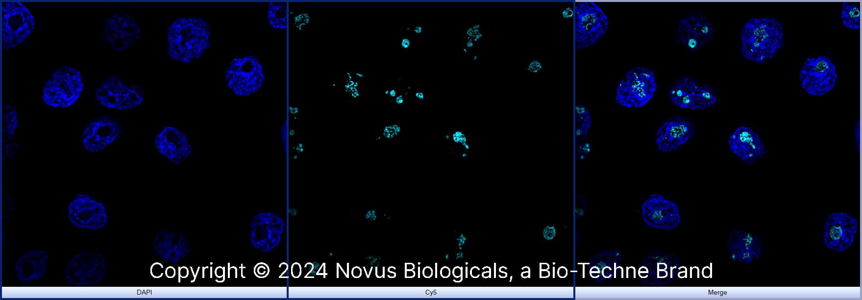 DDX21 was detected in immersion fixed A431 human skin carcinoma cell line using Rabbit anti-DDX21 Antigen Affinity Purified Polyclonal Antibody conjugated to Alexa Fluor® 647 (Catalog # NB100-1718AF647) (light blue) at 5 µg/mL overnight at 4C. Cells were counterstained with DAPI (blue). Cells were imaged using a 100X objective and digitally deconvolved.