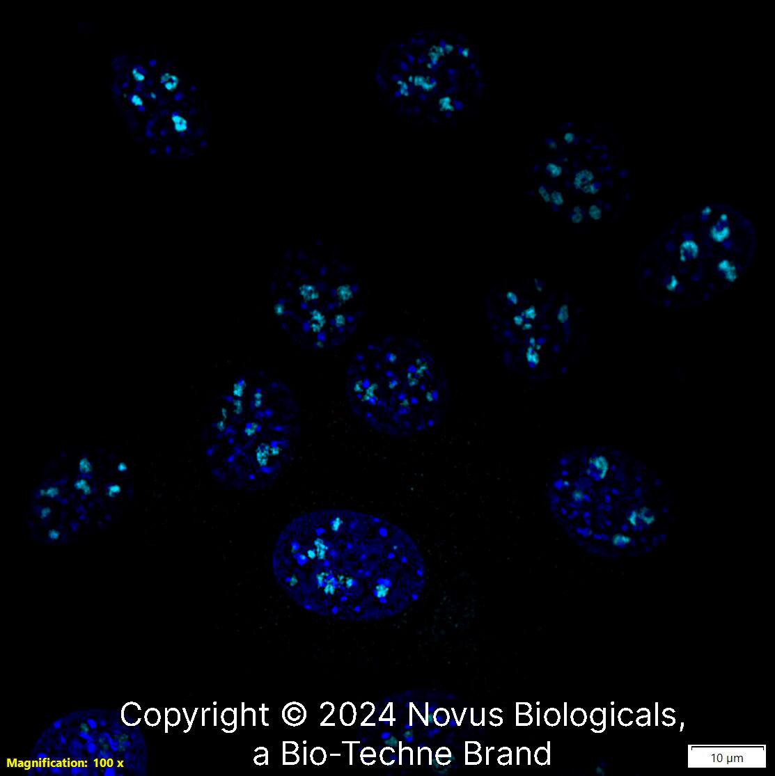 DDX21 was detected in immersion fixed NIH3T3 Mouse fibroblast cell line using Rabbit anti-DDX21 Antigen Affinity-purified Polyclonal Antibody conjugated to Alexa Fluor® 647 (Catalog # NB100-1718AF647) (light blue) at 5 µg/mL overnight at 4C.  Cells were counterstained with DAPI (blue). Cells were imaged using a 100X objective and digitally deconvolved.