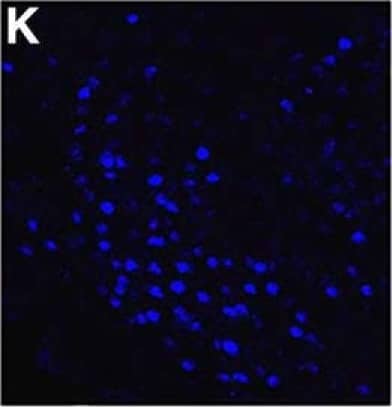 Immunocytochemistry/ Immunofluorescence: NCOA2 Antibody [NB100-1756] - The majority of estradiol-induced PR-A or PR-B cells in the VMN of female mice coexpress SRC-1 & SRC-2. A–P, Representative images taken from vehicle control wt mice (A–D) & estradiol-treated wt mice (E–H), PRBKO mice (that express PR-A only; I–L), & PRAKO mice (that express PR-B only; M–P). Insets show the magnified image of an area within the small square box. Magnification: images, 400×; insets, 630×. Scale bar, 50 μm. Image collected & cropped by CiteAb from the following publication (//pubmed.ncbi.nlm.nih.gov/26465008), licensed under a CC-BY license. Not internally tested by Novus Biologicals.