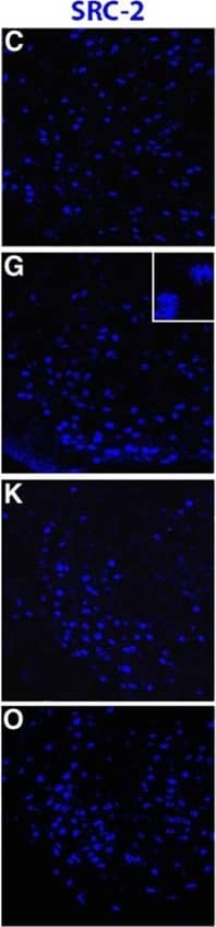 Immunocytochemistry/ Immunofluorescence: NCOA2 Antibody [NB100-1756] - The majority of estradiol-induced PR-A or PR-B cells in the VMN of female mice coexpress SRC-1 & SRC-2. A–P, Representative images taken from vehicle control wt mice (A–D) & estradiol-treated wt mice (E–H), PRBKO mice (that express PR-A only; I–L), & PRAKO mice (that express PR-B only; M–P). Insets show the magnified image of an area within the small square box. Magnification: images, 400×; insets, 630×. Scale bar, 50 μm. Image collected & cropped by CiteAb from the following publication (//pubmed.ncbi.nlm.nih.gov/26465008), licensed under a CC-BY license. Not internally tested by Novus Biologicals.