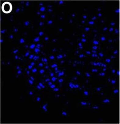 Immunocytochemistry/ Immunofluorescence: NCOA2 Antibody [NB100-1756] - The majority of estradiol-induced PR-A or PR-B cells in the VMN of female mice coexpress SRC-1 & SRC-2. A–P, Representative images taken from vehicle control wt mice (A–D) & estradiol-treated wt mice (E–H), PRBKO mice (that express PR-A only; I–L), & PRAKO mice (that express PR-B only; M–P). Insets show the magnified image of an area within the small square box. Magnification: images, 400×; insets, 630×. Scale bar, 50 μm. Image collected & cropped by CiteAb from the following publication (//pubmed.ncbi.nlm.nih.gov/26465008), licensed under a CC-BY license. Not internally tested by Novus Biologicals.