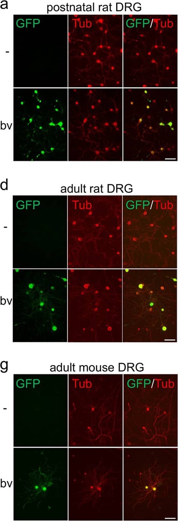 Immunocytochemistry/ Immunofluorescence: GFP Antibody [NB100-1770] - Transduction of dorsal root ganglion neurons.Dissociated dorsal root ganglion neurons (DRG) isolated from postnatal (a–c) or adult (d–f) rats & adult mice (g–i) were transduced with fGFP-baculovirus (bv). Representative pictures of vehicle (-) & bv -treated cultures (a,d,g) show transduced, GFP-expressing neurons (green) that were co-stained with the neuronal marker  beta III-tubulin (Tub, red) at 2 days after transduction (d.a.t.). The percentage of transduced, GFP-expressing DRG neurons was determined at 1, 2 & 3 d.a.t. (b,e,h), revealing similar transduction efficiencies of 80–90% in postnatal & adult DRG neurons. Cell survival in postnatal (c) & adult (f, i) DRG cultures was not affected by bv-application compared to vehicle-treated controls (-). Scale bars: 100 μm. Image collected & cropped by CiteAb from the following publication (//www.nature.com/articles/srep38928), licensed under a CC-BY license. Not internally tested by Novus Biologicals.