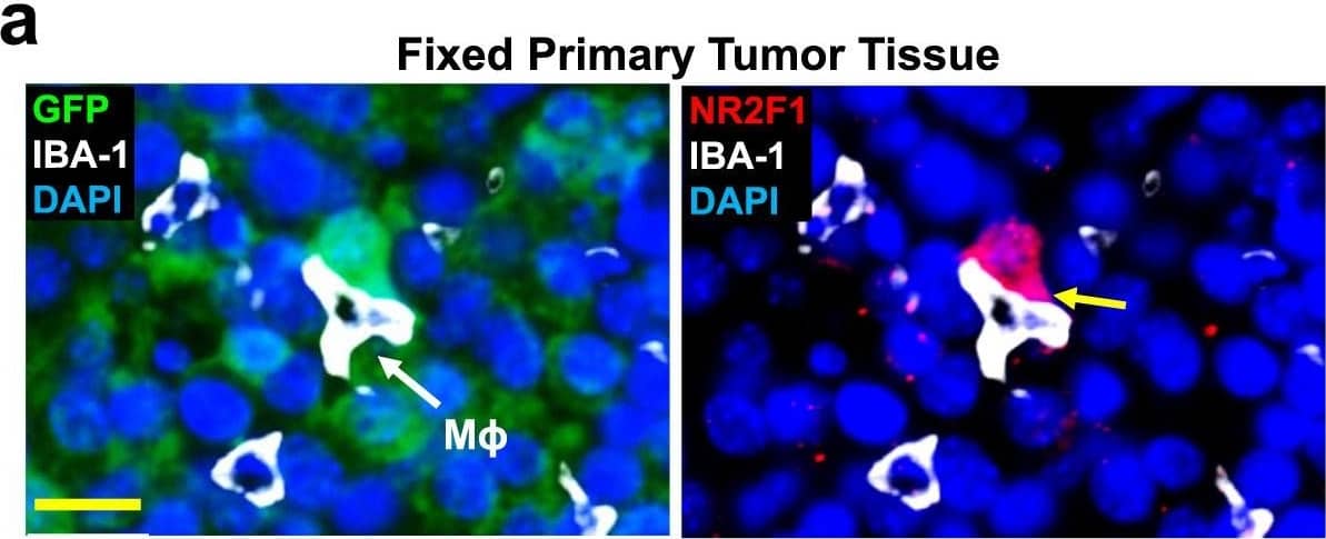 Immunohistochemistry: GFP Antibody [NB100-1770] - Macrophages regulate dormancy in tumor cells.a Representative image of triple immunofluorescently stained in E0771-GFP primary tumor tissue for tumor cells, macrophages, & NR2F1. Green = GFP; Red = NR2F1; White = IBA-1; Blue = DAPI. White arrow shows a macrophage. The yellow arrow contact between an NR2F1-positive tumor cell & a macrophage. Mϕ=Macrophage. Scale bar=20 μm. b Quantification showing frequency of distances between NR2F1+ tumor cells to nearest macrophage in primary tumor. Data is normalized to frequency of distances between all DAPI+ nuclei to nearest TMEM. Bar = mean. Error bars = ±SEM. n = 34 fields of view (551 × 316 µm2) in 4 animals. For comparison between 0 & 200 µm bins a two-tailed Mann-Whitney test used (p < 0.0001). ****p < 0.0001. c Representative immunofluorescence images of NR2F1 expression in E0771-GFP tumor cells cultured alone, in direct contact w/ BAC1.2F5 macrophages, or in direct contact w/ HUVEC endothelial cells. White arrows show macrophages or endothelial cells in direct contact w/ a tumor cell. Green = GFP; Red = NR2F1; Blue = DAPI. TC = Tumor Cell. Mϕ = Macrophage. EC = Endothelial Cell. Scale bar = 15 μm. d Percentage of NR2F1-positive tumor cells from each group in C. TC alone: n = 777 cells in 9 independent experiments; TC+Mϕ; n = 226 cells in 6 independent experiments, TC+EC = n = 359 cells in 4 independent experiments. Bar = mean. Error bars = ±SEM. For TC vs. TC+Mϕ (p = 0.0039), & for TC vs. TC+EC (p = 1), a two-tailed Kruskal-Wallis test w/ Dunn’s multiple comparisons adjustment used. For TC+Mϕ vs. TC+EC (0.012), a two-tailed one-way ANOVA w/ Sidak’s multiple comparison adjustment used. *p < 0.05. **p < 0.01; ns = not significant. Source data are provided as a Source Data file. Image collected & cropped by CiteAb from following publication (//pubmed.ncbi.nlm.nih.gov/35110548), licensed under a CC-BY license. Not internally tested by Novus Biologicals.