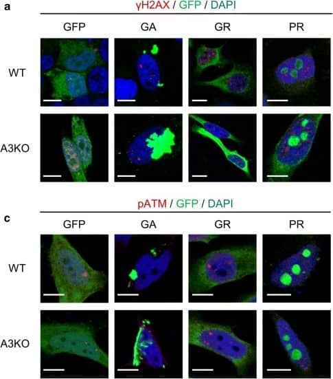 Immunocytochemistry/ Immunofluorescence: GFP Antibody [NB100-1770] - hnRNPA3 knockout enhances DNA damage in DPR expressing HeLa cells. a Immunocytochemical detection of  gamma H2AX foci in GFP-tagged DPR-expressing HeLa WT & A3KO HeLa cells. b Fold change of  gamma H2AX foci in HeLa WT & A3KO cells expressing the indicated DPRs relative to HeLa WT cells with GFP expression. N = 47–127 cells from 2 biological replicates. c Immunocytochemical detection of pATM foci in GFP-tagged DPR-expressing HeLa WT & A3KO HeLa cells. d Fold change of pATM foci in HeLa WT & A3KO cells expressing the indicated DPRs relative to HeLa WT cells with GFP expression. N = 71–263 cells from 2 biological replicates. GFP EGFP transfected, GA EGFP-tagged poly-GA 175 repeats transfected, GR EGFP-tagged poly-GR 177 repeats transfected, PR: EGFP-tagged poly-PR 176 repeats transfected. All graphs are shown as mean ± SEM. *p < 0.05, **p < 0.01; one-way ANOVA & Tukey’s post-hoc test. Scale bar 10 μm Image collected & cropped by CiteAb from the following publication (//pubmed.ncbi.nlm.nih.gov/31642962), licensed under a CC-BY license. Not internally tested by Novus Biologicals.