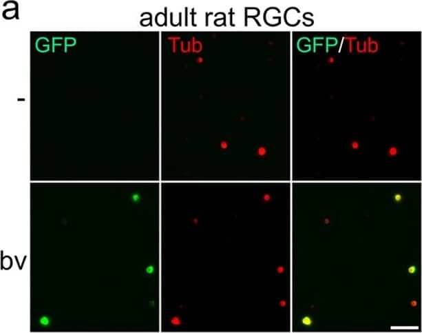 Immunocytochemistry/ Immunofluorescence: GFP Antibody [NB100-1770] - Transduction of mature retinal ganglion cells.Dissociated retinal ganglion cells (RGCs) isolated from adult rats (a–c), mice (d–f) & zebrafish (g–i) were transduced with baculovirus (bv) encoding fGFP (rat & mice) or DsRed (zebrafish). Representative pictures of vehicle- (-) & bv -treated cultures (a,d,g) visualize transduced RGCs (GFP & DsRed, respectively) that were either co-stained with the neuronal marker  beta III-tubulin (Tub, red) at 2 days after transduction (d.a.t) for rat & mice RGCs (a,d) or identified by EGFP expression for zebrafish RGCs at 6 d.a.t. (g). The percentage of transduced RGCs was determined at 1, 2 & 3 days after transduction (d.a.t.) for rat & mice (b,e) & at 4 & 6 d.a.t. for zebrafish (h). Treatment effects compared to vehicle-treated controls: ***p < 0.001, **p < 0.01. Scale bars: 50 μm. RGC survival (c,f,i) was not affected by baculovirus application (bv) compared to vehicle-treated controls (-). (j) Delayed transduction of adult zebrafish RGCs with DsRed-bv after 4 days in culture. Scale bar: 50 μm. (k,l) Co-transduction of adult rat RGCs with fGFP-bv & DsRed-bv. The two viruses were added to retinal cultures simultaneously at half the concentration of single transductions. Representative pictures show co-transduced, fGFP- & DsRed-expressing RGCs (green & red, respectively) that were co-stained against the neuronal marker  beta III-tubulin (white) at 2 d.a.t. Scale bar: 50 μm. (k). The percentage of transduced RGCs was determined at 2 & 3 d.a.t. (l). Non-significant difference in co-tranduction efficiency compared to single transductions. Image collected & cropped by CiteAb from the following publication (//www.nature.com/articles/srep38928), licensed under a CC-BY license. Not internally tested by Novus Biologicals.