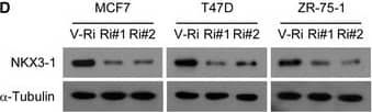 Western Blot: NKX3.1 Antibody (0361) - BSA Free [NB100-1828] - SALL2 transcriptionally upregulates ESR1 in breast cancerARNA‐seq analysis of ESR1 mRNA levels in 9 paired pre‐tamoxifen‐treated primary breast cancer tissues & relapsed tamoxifen‐resistant breast cancer tissues.BqRT–PCR analysis of ESR1 expression in 9 paired pre‐tamoxifen‐treated primary breast cancer tissues & relapsed tamoxifen‐resistant breast cancer tissues. GAPDH was used as an internal control.C, DWB analysis of SALL2 (A) & NKX3‐1 (B) expression in the indicated cells transfected with Ri‐Vector (V‐Ri) or shRNAs (Ri#1/2) against SALL2 or NKX3‐1.  alpha ‐Tubulin was used as the loading control.E, FqRT–PCR analysis of ESR1 expression in the indicated cells transfected with Ri‐Vector or shRNAs (Ri#1/2) against SALL2 or NKX3‐1.Data information: In (A), P‐values were determined by two‐tailed paired Student's t‐test. In (B), data are presented as mean ± SD, & P‐values were determined by two‐tailed unpaired Student's t‐test, n = 3. In (E & F), data are presented as mean ± SD, & P‐values were determined by one‐way ANOVA test, n = 3. *P < 0.05, **P < 0.01, ***P < 0.001, n.s., no significance. Exact P‐values are specified in Appendix Table S10.Source data are available online for this figure. Image collected & cropped by CiteAb from the following publication (//pubmed.ncbi.nlm.nih.gov/31657150), licensed under a CC-BY license. Not internally tested by Novus Biologicals.