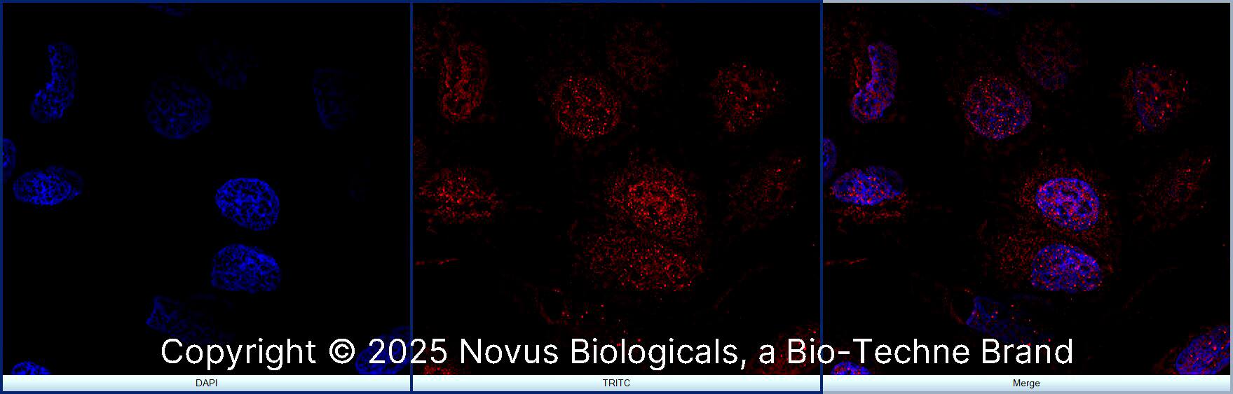 FANCD2 was detected in immersion fixed U-2 OS human osteosarcoma cell line using Rabbit anti-FANCD2 Antigen Affinity Purified Polyclonal Antibody conjugated to Biotin (Catalog # NB100-182B) at 5 µg/mL overnight at 4C. Cells were stained using Streptavidin conjugated to DyLight 550 (red) and counterstained with DAPI (blue). Cells were imaged using a 100X objective and digitally deconvolved.
