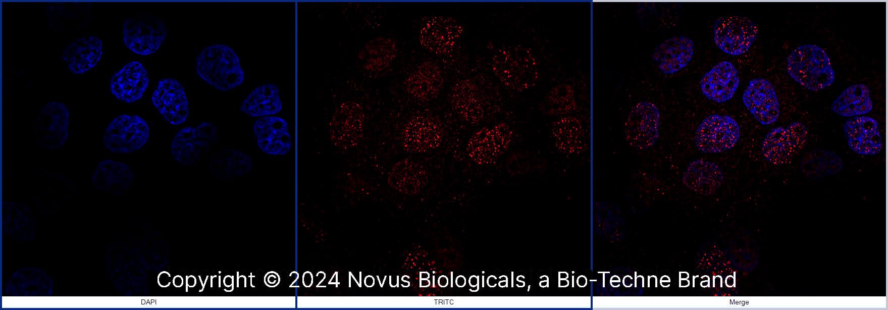 FANCD2 was detected in immersion fixed A431 human skin carcinoma cell line using Rabbit anti-FANCD2 Antigen Affinity Purified Polyclonal Antibody conjugated to DyLight 550 (Catalog # NB100-182R) (red) at 5 µg/mL overnight at 4C. Cells were counterstained with DAPI (blue). Cells were imaged using a 100X objective and digitally deconvolved.