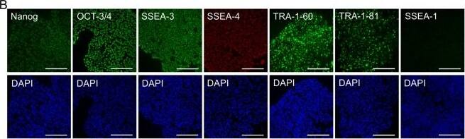 PSC characterisation. (A) Human PSC-1 characterized for A) typical undifferentiated colony morphology in phase contrast image and (B) expression of pluripotency markers Nanog, OCT-3/4, SSEA-3, SSEA-4, TRA-1-60, and TRA-1-81, and lack of expression of early differentiation marker SSEA-1 after immunofluorescence staining. Corresponding nuclei stains with DAPI shown. (C) Cells showed normal female (46, XX) karyotype after 28 passages in total (9 passages in feeder-free culture). The results of the KaryoLite BoBs assay are shown as signal relative to karyotypically normal female (/F, red) and male (/M, blue) genomic DNA used as a reference (equal to 1) for each of the probes covering both p and q arms of all chromosomes. Software threshold for changes shown as a green lines and deviations in red. (D) Pluripotency shown after spontaneous differentiation in vitro as expression of markers for mesoderm, endoderm, and ectoderm. All scale bars 200 um. Image collected and cropped by CiteAb from the following open publication (//pubmed.ncbi.nlm.nih.gov/30341351), licensed under a CC-BY license. Not internally tested by Novus Biologicals.