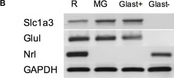 Western Blot: EAAT1/GLAST-1/SLC1A3 Antibody - BSA Free [NB100-1869] - Damage response is restricted to MG. (A) RT-PCR analysis for Slc1a3, the gene encoding GLAST, at the indicated times after injury. (B) RT-PCR for MG & a photoreceptor-specific marker (Nrl) in GLAST-positive & negative fractions, after MACS in intact retinas. (C–F) qPCR quantification of Oct4, Nanog, Lin28, & Dnmt3b expression levels at the indicated time after injury in MACS GLAST-positive & negative fraction; C, intact retina as control (Student's t-test; ***p < 0.001; **p < 0.01; *p < 0.05). Image collected & cropped by CiteAb from the following publication (//journal.frontiersin.org/article/10.3389/fnins.2016.00523/full), licensed under a CC-BY license. Not internally tested by Novus Biologicals.