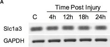 Western Blot: EAAT1/GLAST-1/SLC1A3 Antibody - BSA Free [NB100-1869] - Damage response is restricted to MG. (A) RT-PCR analysis for Slc1a3, the gene encoding GLAST, at the indicated times after injury. (B) RT-PCR for MG & a photoreceptor-specific marker (Nrl) in GLAST-positive & negative fractions, after MACS in intact retinas. (C–F) qPCR quantification of Oct4, Nanog, Lin28, & Dnmt3b expression levels at the indicated time after injury in MACS GLAST-positive & negative fraction; C, intact retina as control (Student's t-test; ***p < 0.001; **p < 0.01; *p < 0.05). Image collected & cropped by CiteAb from the following publication (//journal.frontiersin.org/article/10.3389/fnins.2016.00523/full), licensed under a CC-BY license. Not internally tested by Novus Biologicals.