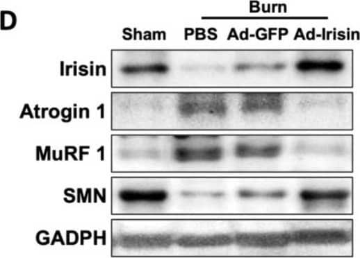 Spinal irisin gene delivery attenuated burn injury-induced atrophy markers and reduced irisin and SMN expression in ipsilateral gastrocnemius muscle. (A) Immunofluorescence staining of atrogin-1 and MuRF in ipsilateral gastrocnemius muscle in the fourth week after burn injury. DAPI counterstain was used to locate the nucleus. (B,C) Representative bar graphs illustrating averaged optical intensity of atrogin-1 and MuRF. Error bars represent standard deviations (SDs). ** p < 0.01, *** p < 0.001, unpaired t-test. (D) Immunoblot of ipsilateral gastrocnemius muscle tissue in the fourth week after burn injury. (E–H) Representative bar graphs illustrating normalized expression ratio of irisin, atrogin-1, MuRF, and SMN, with GAPDH as an internal control. Error bars represent SDs. * p < 0.05, ** p < 0.01, unpaired t-test. Image collected and cropped by CiteAb from the following open publication (//pubmed.ncbi.nlm.nih.gov/36555538), licensed under a CC-BY license. Not internally tested by Novus Biologicals.
