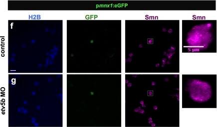 Immunocytochemistry/ Immunofluorescence: SMN Antibody (2B1) [Alexa Fluor® 647] [NB100-1936AF647] - Etv5b activates the smn promoter leading to increased Smn levels in motoneurons.(a–d) Whole-mount in situ hybridization of etv5b expression in 24 hpf embryos. Expression pattern in the entire embryo (a), in magnified lateral (b) & dorsal (c) views as well as in a transverse section (d) of the trunk. In the latter case, yellow arrowhead denote signal in the motoneuron region. Scale bars: 100 μm (a) & 50 μm (b–d). nc, notochord. (e) RT-PCR in control (C - only psmn:mCherry) versus etv5b overexpressing (OE - etv5b mRNA & psmn:mCherry) embryos at early gastrula stage. (f,g) scIF of control (f) & etv5b MO (g) cells from pmnx1:eGFP embryos. H2B, GFP & Smn signals are shown in Z-projected confocal sections. GFP+ cells marked by white rectangles are magnified on the right. Scale bars: 10 μm for low & 5 μm for high magnification. (h) Relative Smn signal in control & in etv5b MO cells from one representative experiment. Exact values are (mean ± SD): 0.99 ± 0.25 (control) & 0.7 ± 0.14 (etvb5 MO), p = 0.003 with Wilcoxon Sum Rank Test. (i) Average relative Smn levels in control & in etv5b MO motoneurons. The exact value of decrease is 0.75 ± 0.04 (mean ± SD). N = 3 experiments, n = number of analyzed cells. Image collected & cropped by CiteAb from the following publication (//www.nature.com/articles/srep27470), licensed under a CC-BY license. Not internally tested by Novus Biologicals.