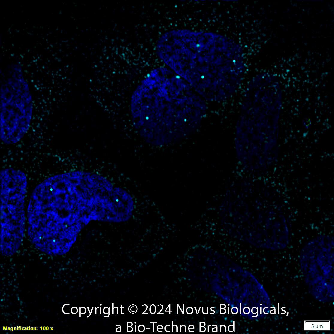 SMN (2B1) was detected in immersion fixed U-2 OS human osteosarcoma cell line using Mouse anti-SMN (2B1) Protein G Purified Monoclonal Antibody conjugated to Alexa Fluor® 647 (Catalog # NB100-1936AF647) (light blue) at 5 µg/mL overnight at 4C. Cells were counterstained with DAPI (dark blue). Cells were imaged using a 100X objective and digitally deconvolved.