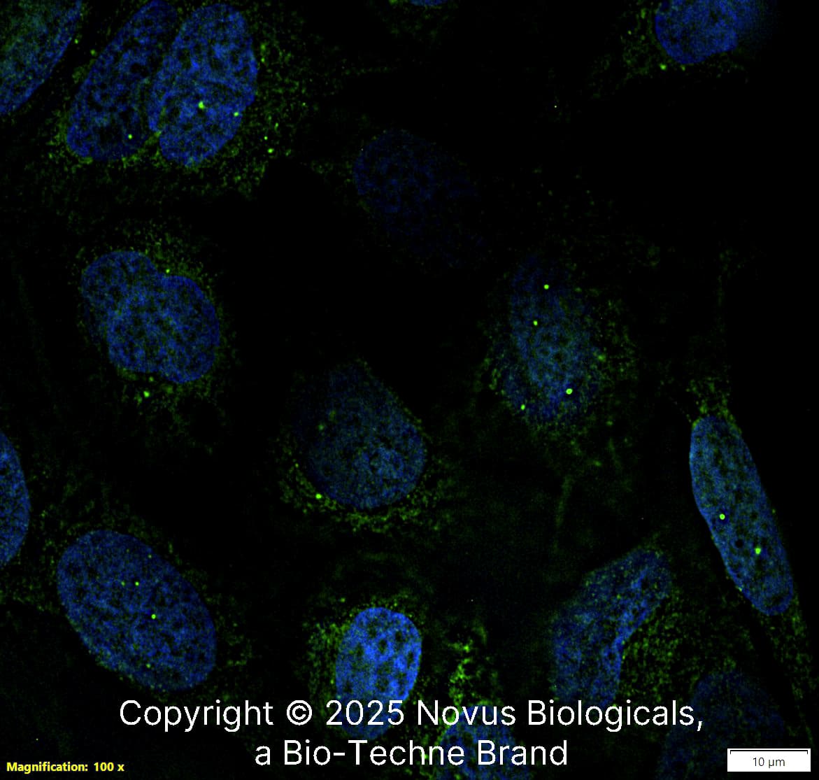 SMN (2B1) was detected in immersion fixed U-2 OS human osteosarcoma cell line using Mouse anti-SMN (2B1) Protein G Purified Monoclonal Antibody conjugated to DyLight 488 (Catalog # NB100-1936G) (green) at 5 µg/mL overnight at 4C. Cells were counterstained with DAPI (blue). Cells were imaged using a 100X objective and digitally deconvolved.  