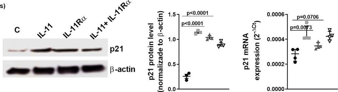 rhIL-11 and soluble rhIL-11R alpha  promotes time-dependent proliferation and senescence in human pulmonary artery endothelial cells (HPAEC) and smooth muscle cells (HPASMC). A HPAECs or B HPASMCs were isolated from control donor subjects and stimulated with rhIL-11 5 ng/ml, rhIL-11R alpha  10 ng/ml or its combination at indicated times. Experiments were done between passages 2–3. Cell proliferation was measured by the BrDU kit at 24 h, 48 h, 72 h and 96 h. Cell senescence was measured after 72 h of cell stimulation using  beta -galactosidase histology and P21 expression. Results were expressed as % senescence ( beta -galactosidase blue positive cells) relative to the total number of cells in each field. P21 expression was measured by quantitative PCR (qPCR) as 2− delta Ct and western blot. Data are presented as scatter dot blot with median and interquartile range values (for primary cells, n = 3–4 control subjects performed in triplicate). P-values are based on the Kruskal–Wallis test and Dunn’s post-hoc test for multiple comparison Image collected and cropped by CiteAb from the following open publication (//pubmed.ncbi.nlm.nih.gov/36376885), licensed under a CC-BY license. Not internally tested by Novus Biologicals.