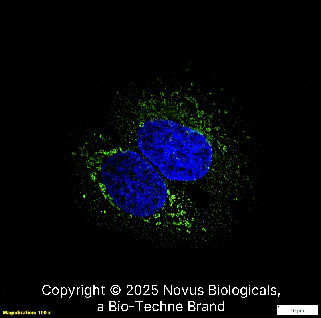 CD74 (PIN.1) was detected in immersion fixed U-2 OS human osteosarcoma cell line using Mouse anti-CD74 (PIN.1) Protein-G purified Monoclonal Antibody conjugated to Alexa Fluor® 488 (Catalog # NB100-1985AF488) (green) at 5 µg/mL overnight at 4C. Cells were counterstained with DAPI (blue). Cells were imaged using a 100X objective and digitally deconvolved.  