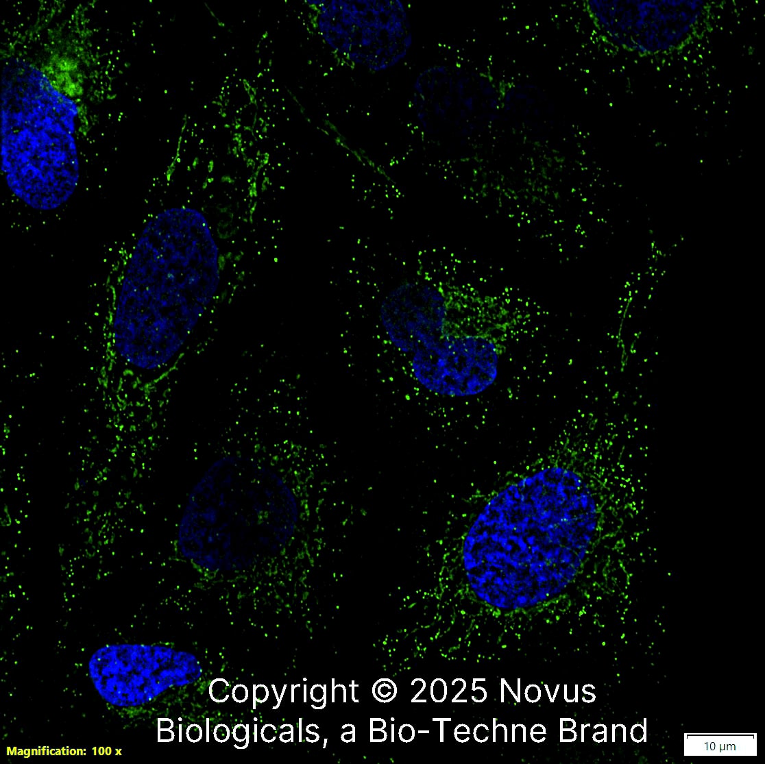 CD74 (PIN.1) was detected in immersion fixed U-2 OS human osteosarcoma cell line using Mouse anti-CD74 (PIN.1) Protein-G purified Monoclonal Antibody conjugated to FITC (Catalog # NB100-1985F) (green) at 2 µg/mL overnight at 4C. Cells were counterstained with DAPI (blue). Cells were imaged using a 100X objective and digitally deconvolved.  