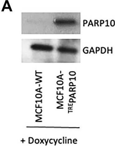 Identification of genes necessary for proliferation of PARP10-overexpressing MCF10A breast epithelial cells by CRISPR-mediated genome-wide loss-of-function screening.(A) Western blot showing doxycycline-induced overexpression of PARP10 in MCF10A cells. (B) Overview of the CRISPR knockout screens to identify genes that are specifically required for proliferation of PARP10-overexpressing MCF10A cells. (C) Scatterplot showing the results of genome-wide CRISPR knockout screens to identify genes that are specifically required for proliferation of PARP10-overexpressing MCF10A cells. Each gene targeted by the library was ranked according to the MAGeCK score indicating genes which, when inactivated, specifically cause reduced proliferation in PARP10-overexpressing MCF10A-TREPARP10 cells compared to control MCF10A cells. Top hits chosen for validation are indicated. (D, E) Biological pathway analyses using KEGG (D) or Gene Ontology (E) analyses of the top hits with p-values lower than 0.02 which specifically cause reduced proliferation in PARP10-overexpressing MCF10A-TREPARP10 cells compared to control MCF10A cells. KEGG terms with negative logP greater than 1 are shown. GO_BP terms with negative logP greater than 1.24 are presented (corresponding to the top 20 pathways). Image collected and cropped by CiteAb from the following open publication (//pubmed.ncbi.nlm.nih.gov/36187556), licensed under a CC-BY license. Not internally tested by Novus Biologicals.