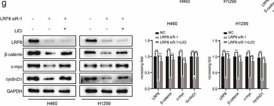LRP8 motivated NSCLC cells development and metastasis via the Wnt/ beta -catenin signaling pathway. (a) Expression of Wnt/ beta -catenin signaling components after silencing LRP8 as detected by Western blotting assays. (b) Expression of Wnt/ beta -catenin signaling-related factors in overexpression LRP8 group of H1975 cells. CCK-8 assay (c) and colony formation analysis (d) were carried out to evaluate the proliferation abilities of H1299 and H460 cells transfected with LRP8 siRNA or negative vector or LiCl and LRP8 siRNA. (e) Invasion and migration of H1299 and H460 cells after LRP8 downregulation and LiCl addition as detected by Transwell assay. (f) Western blotting analysis for E-cadherin, Vimentin, and N-cadherin to detect the effect of LiCl in LRP8 knockdown. (g) Western blotting assays were performed to elaborate the role of LiCl in Wnt/ beta -catenin signaling-related factors induced by LRP8 silencing. **p < 0.01. Each experiment was repeated in three independent trials, and mean +/- SD was used to describe the results. Image collected and cropped by CiteAb from the following open publication (//pubmed.ncbi.nlm.nih.gov/35246020), licensed under a CC-BY license. Not internally tested by Novus Biologicals.