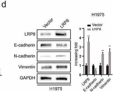 LRP8 enhanced the metastasis of NSCLC cells. (a) Transwell analysis was performed to compare the metastasis potential in the LRP8 knockdown group. (b) H1975 cells migration and invasion capability were detected by transwell assays. The expression of proteins related to metastasis in H1299 and H460 cells (c) and H1975 cells (d) were detected by Western blotting. **p < 0.01. At least three replicate experiments were performed, and the final results were presented as mean +/- SD. Image collected and cropped by CiteAb from the following open publication (//pubmed.ncbi.nlm.nih.gov/35246020), licensed under a CC-BY license. Not internally tested by Novus Biologicals.