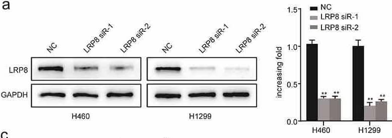 LRP8 promoted NSCLC proliferation in vitro. Western blotting experiments were conducted to validate the transfection efficiency of LRP8 siRNA in H460 and H1299 (a) and LRP8 overexpression plasmid in H1975 (d). CCK-8 assay was used to evaluate the proliferation ability of H460 and H1299 cells transfected with LRP8 siRNAs (b) and H1975 cells with LRP8 plasmid (e). (c) Colony formation analysis showing differences in H1299 and H460 cell proliferation among the three groups. (f) H1975 cell viability was measured using colony formation analysis. **p < 0.01. All experiments were performed independently at least three times, and the results were presented as mean +/- SD. Image collected and cropped by CiteAb from the following open publication (//pubmed.ncbi.nlm.nih.gov/35246020), licensed under a CC-BY license. Not internally tested by Novus Biologicals.