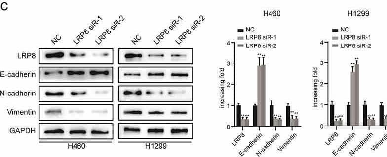 LRP8 enhanced the metastasis of NSCLC cells. (a) Transwell analysis was performed to compare the metastasis potential in the LRP8 knockdown group. (b) H1975 cells migration and invasion capability were detected by transwell assays. The expression of proteins related to metastasis in H1299 and H460 cells (c) and H1975 cells (d) were detected by Western blotting. **p < 0.01. At least three replicate experiments were performed, and the final results were presented as mean +/- SD. Image collected and cropped by CiteAb from the following open publication (//pubmed.ncbi.nlm.nih.gov/35246020), licensed under a CC-BY license. Not internally tested by Novus Biologicals.