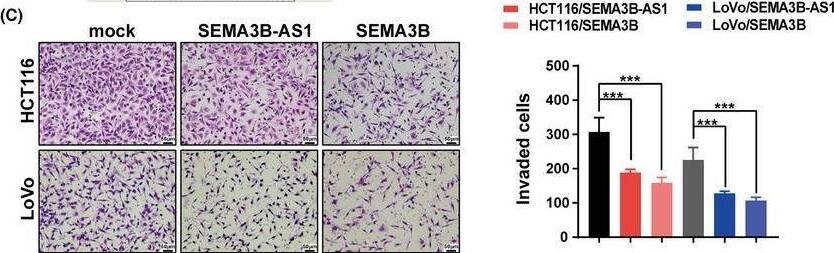 SEMA3B overexpression inhibits angiogenesis and the vascular endothelial growth factor (VEGF) pathway. (A) Gene set enrichment analysis (GSEA) showed the enrichment of the VEGF pathway in CRC cells with SEMA3B downregulation. (B) Overexpression of SEMA3B‐AS1 or SEMA3B increased the content of SEMA3B protein in the supernatant of colorectal cancer cells. (C) Colorectal carcinoma (CRC) cell supernatant overexpressing SEMA3B‐AS1 or SEMA3B inhibited the invasion ability of endothelial cells. Representative images (left) and the statistical analysis (right) are shown. Scale bars indicate 50 μm. (D) CRC cell supernatant overexpressing SEMA3B‐AS1 or SEMA3B inhibited the tube formation of endothelial cells in vitro. Scale bars indicate 100 μm. (E) The chorioallantoic membrane (CAM) assay was used to examine blood vessel formation after stimulation with the supernatants from the indicated cells. The yellow circles indicate locations where conditioned medium was used. *p < 0.05; **p < 0.01; ***p < 0.001. Image collected and cropped by CiteAb from the following open publication (//pubmed.ncbi.nlm.nih.gov/37701532), licensed under a CC-BY license. Not internally tested by Novus Biologicals.