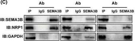 Western Blot Semaphorin 3B Antibody - BSA Free
